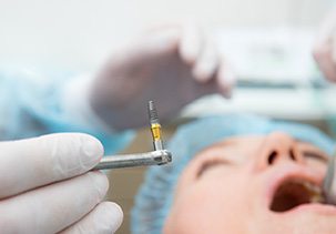 Dental implant surgery