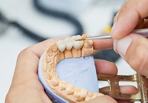 Wax mold of denture being crafted