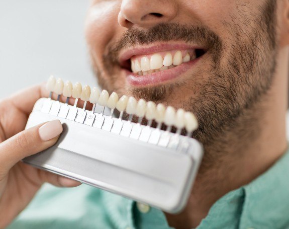 Man's smile compared with porcelain veneers shade chart