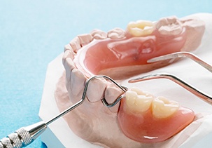 partial dentures sitting on a plaster mouth cast