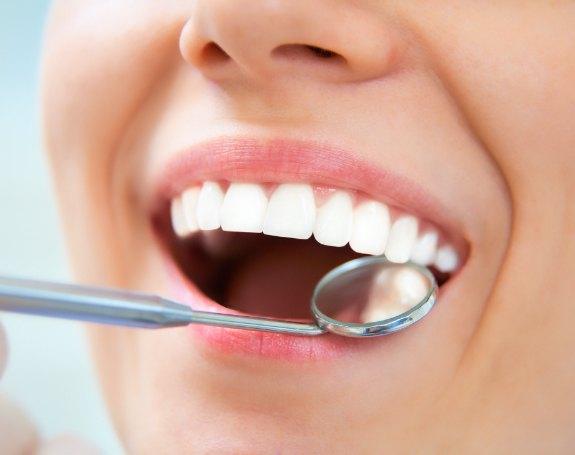 Dentist examining patient's smile after tooth colored filling treatment