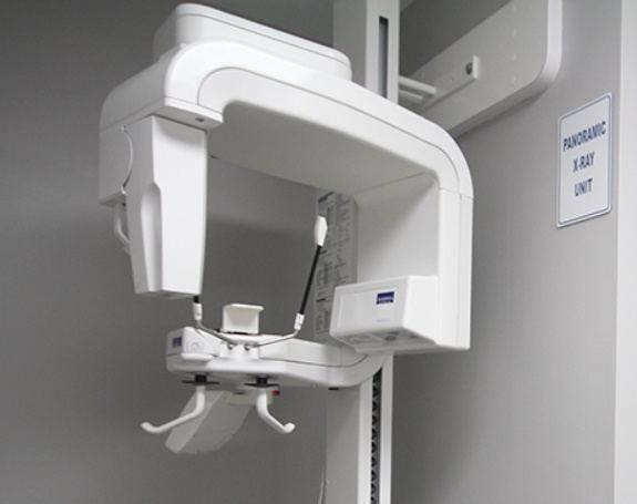 3 D C T cone beam x-ray scanner system