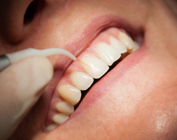 Patient receiving soft tissue laser dentistry treatment