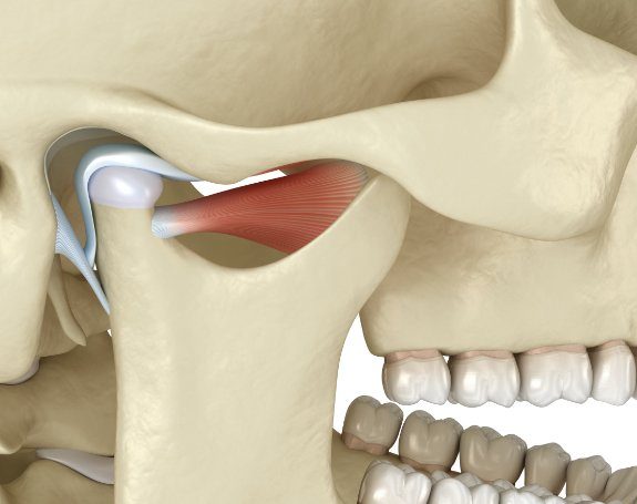 Animated jaw and skull bone used for T M J diagnosis and treatment planning