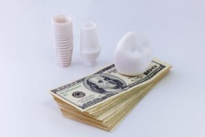 Dental implant on stack of cash